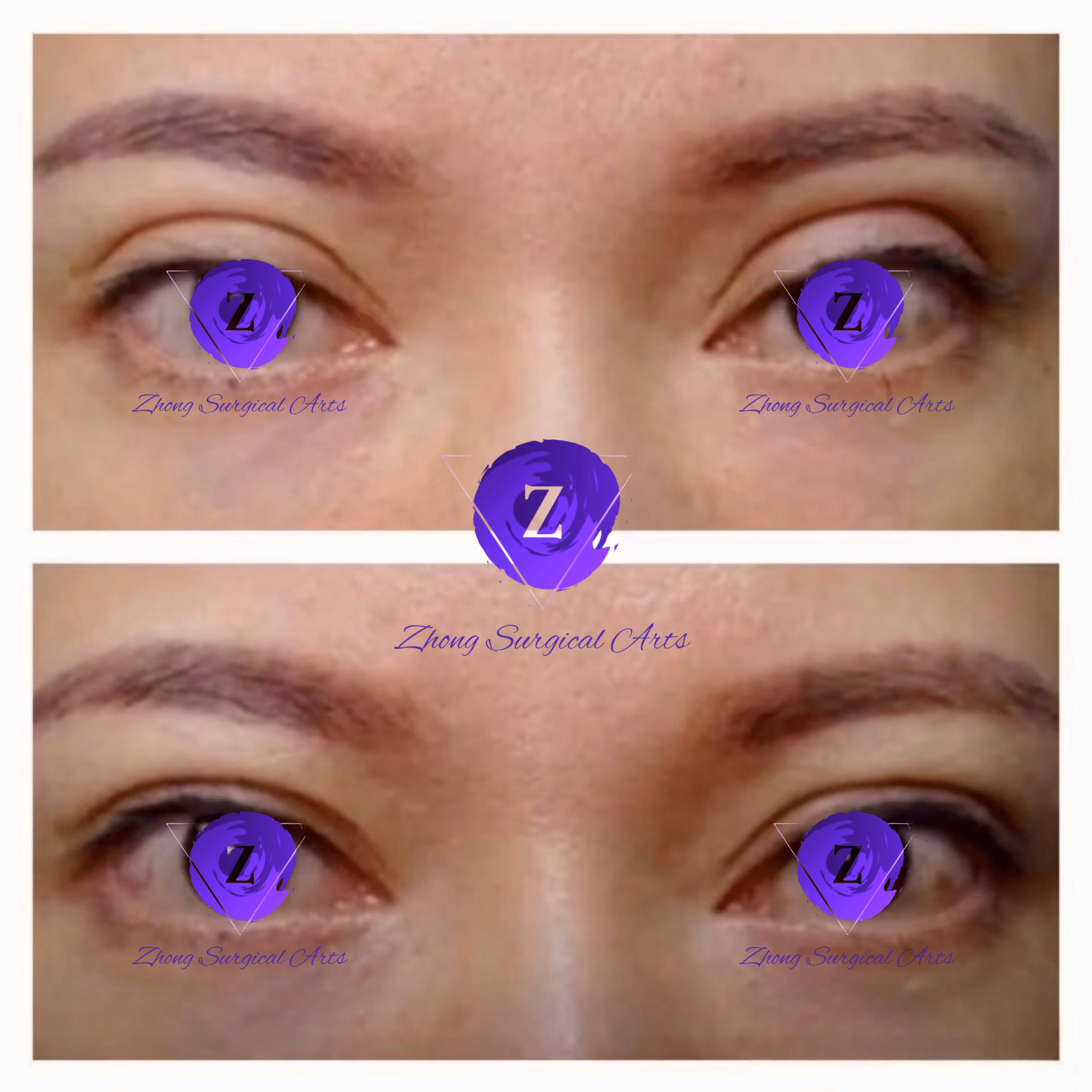 Art of Transformation