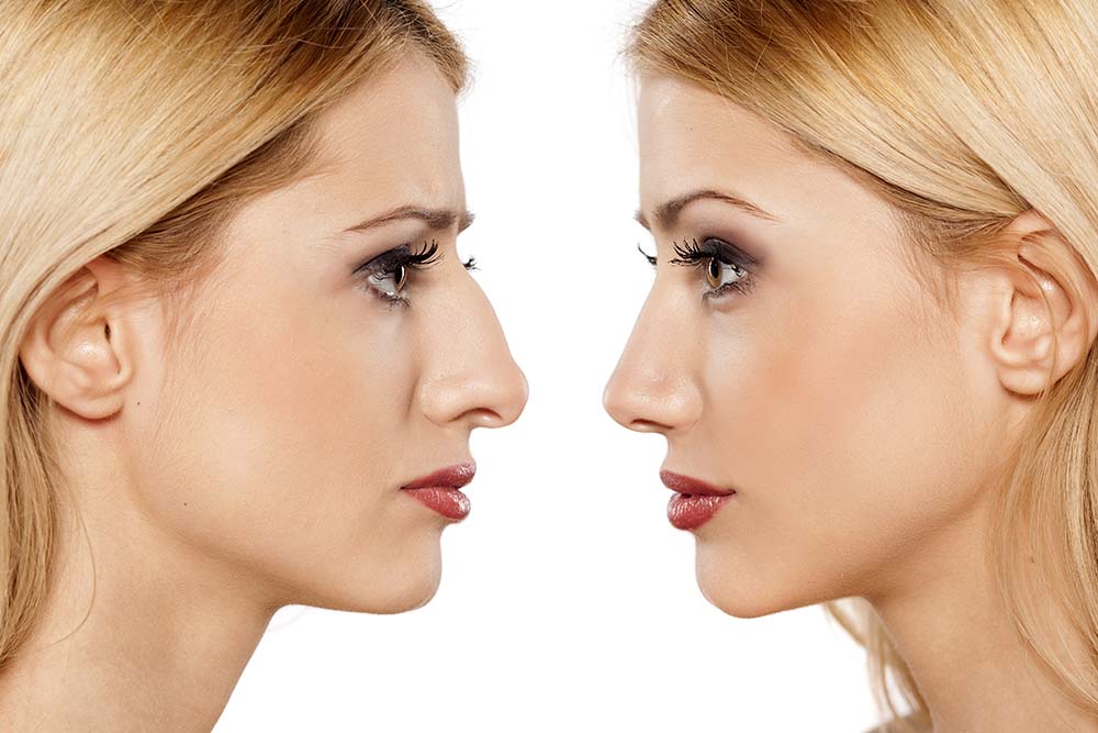 What Patients Really Look for in the Best Facelift Doctor in Coral Springs