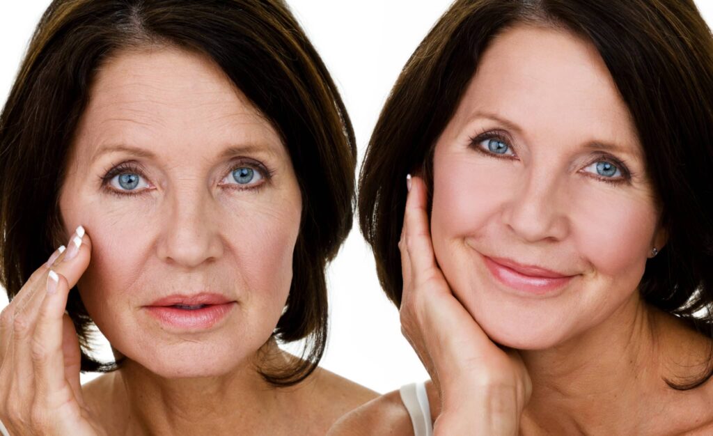 Looking for Facial Rejuvenation Surgery FL Get details on procedures benefits recovery time and expert tips for achieving a natural youthful look