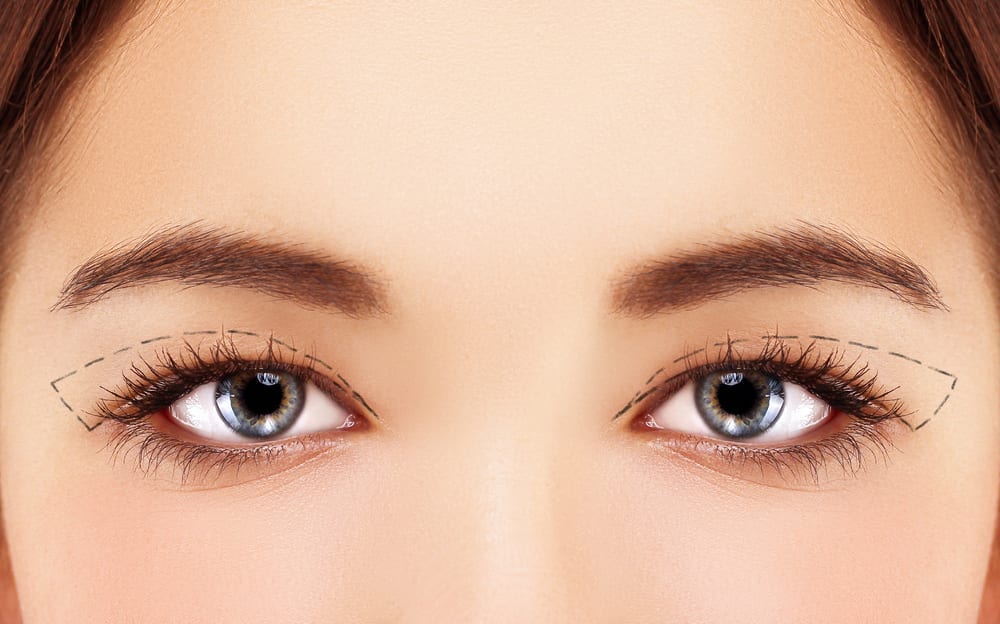 Learn about Blepharoplasty in Coral Springs including procedure benefits recovery steps and how to achieve youthful natural eye appearance Learn about Blepharoplasty in Coral Springs including procedure benefits recovery steps and how to achieve youthful natural eye appearance