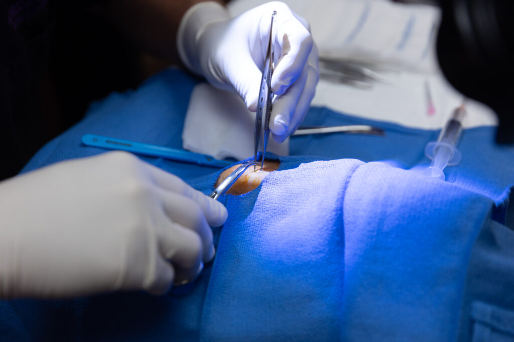 Looking for Cheap Cosmetic Surgery Florida? Learn how to find trusted clinics offering safe procedures, expert care, and natural looking outcomes. Looking for Cheap Cosmetic Surgery Florida? Learn how to find trusted clinics offering safe procedures, expert care, and natural looking outcomes.