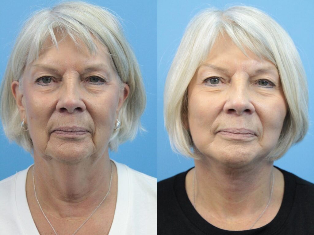 Discover how to choose a Cosmetic Surgery Specialist near me by checking qualifications, before-and-after photos, and patient feedback. Discover how to choose a Cosmetic Surgery Specialist near me by checking qualifications, before-and-after photos, and patient feedback.