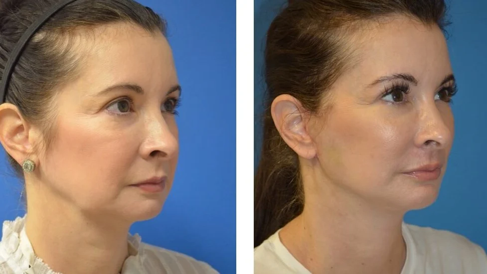 Find out how to choose a Cosmetic Surgery Specialist by considering their experience, credentials, approach to care, and the procedures they offer. Find out how to choose a Cosmetic Surgery Specialist by considering their experience, credentials, approach to care, and the procedures they offer.