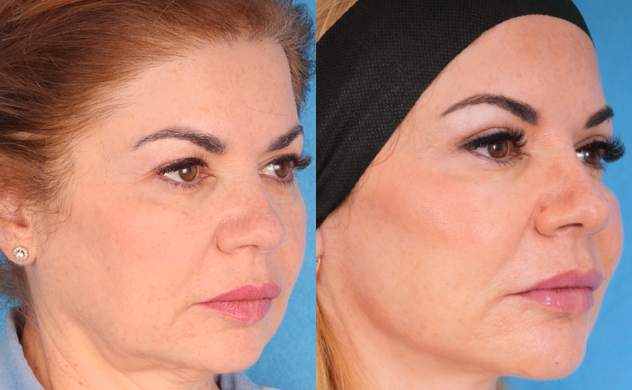 Find out how to choose a Cosmetic Surgery Specialist by considering their experience, credentials, approach to care, and the procedures they offer. Find out how to choose a Cosmetic Surgery Specialist by considering their experience, credentials, approach to care, and the procedures they offer.