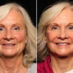 Find out how to choose a Cosmetic Surgery Specialist by considering their experience, credentials, approach to care, and the procedures they offer.