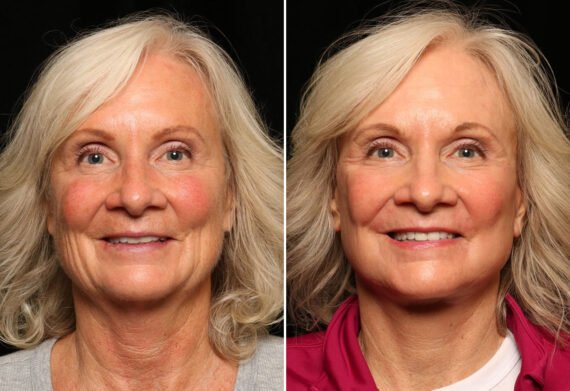 Find out how to choose a Cosmetic Surgery Specialist by considering their experience, credentials, approach to care, and the procedures they offer.