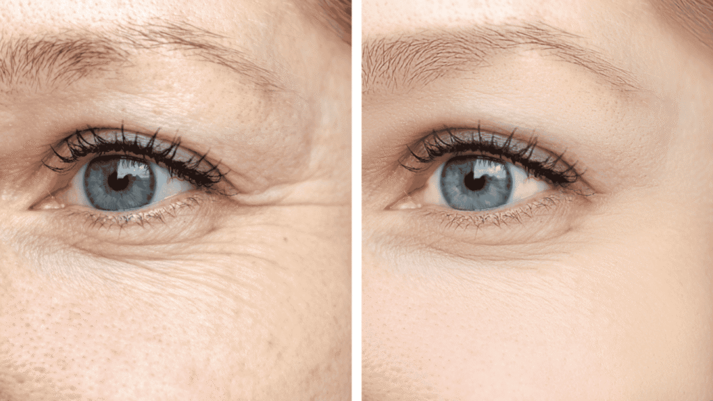 Explore Eyelid Surgery Coral Springs FL, from treatment options and benefits to recovery tips and important questions to ask before your procedure. Explore Eyelid Surgery Coral Springs FL, from treatment options and benefits to recovery tips and important questions to ask before your procedure.