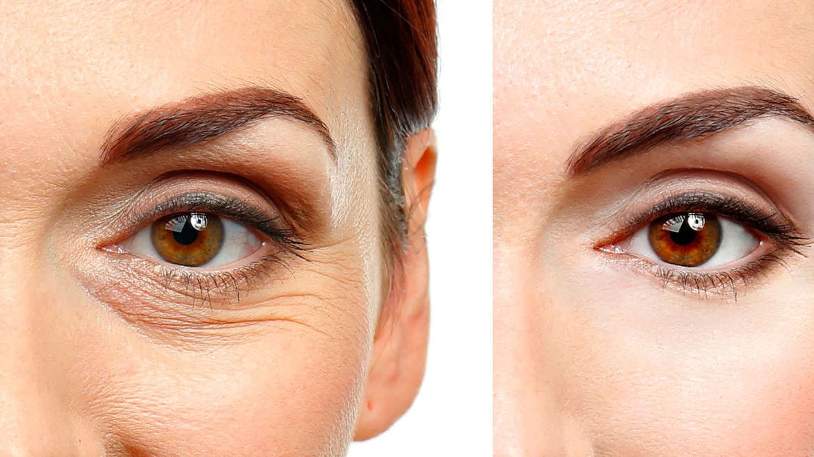 Explore Eyelid Surgery Coral Springs FL, from treatment options and benefits to recovery tips and important questions to ask before your procedure. Explore Eyelid Surgery Coral Springs FL, from treatment options and benefits to recovery tips and important questions to ask before your procedure.