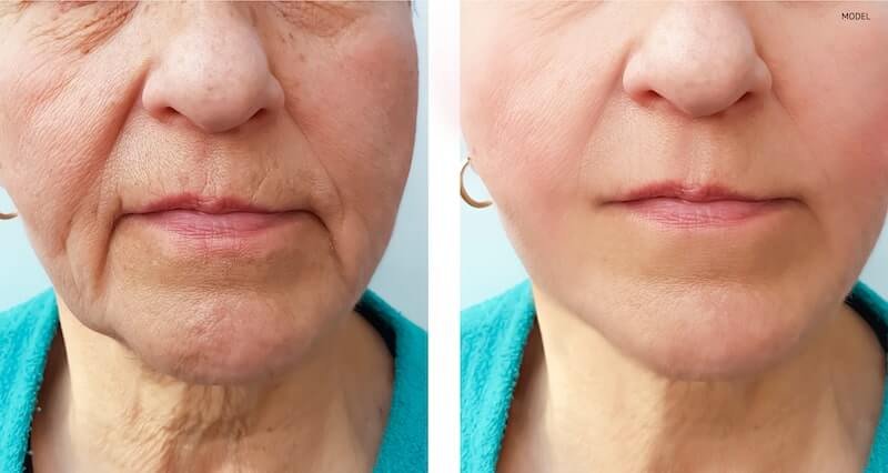 Learn about Facial Surgery options in Florida, including common procedures, potential benefits, and what to consider before choosing treatment.