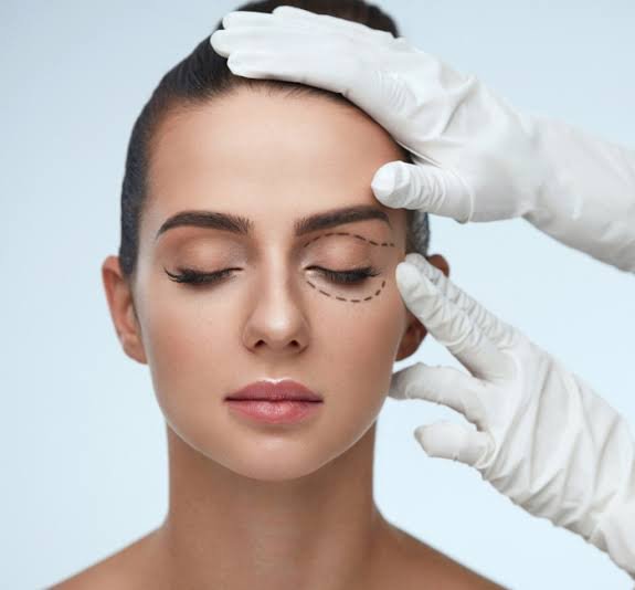 What to Know Before Choosing Blepharoplasty Coral Springs, FL