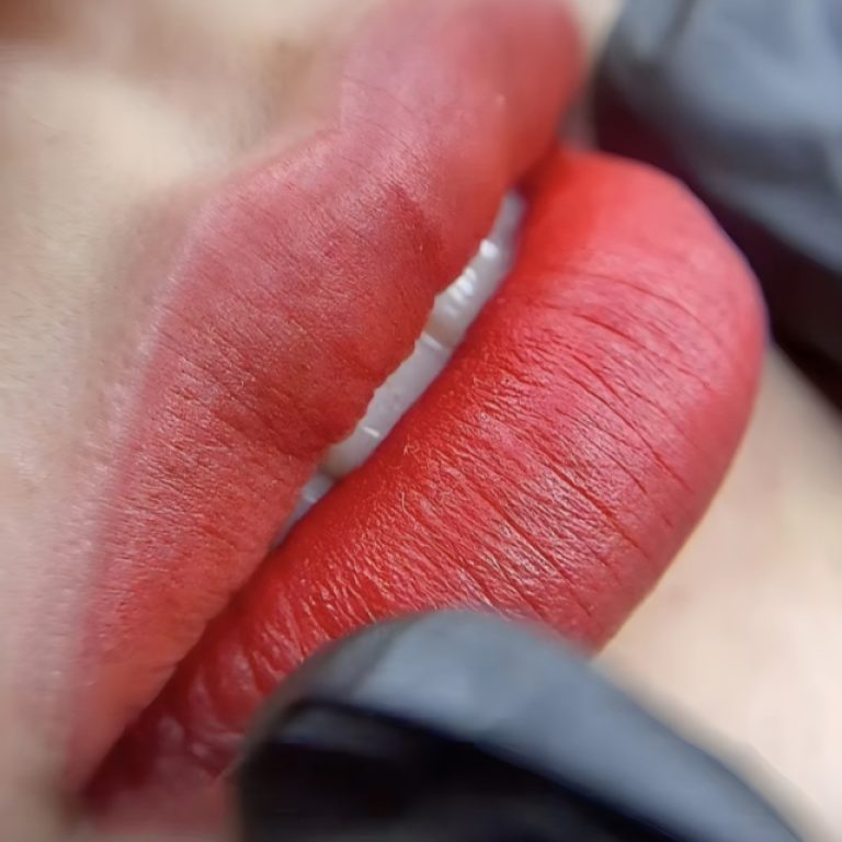 Trust our Coral Springs FL specialist for Upper Lip Lift Surgery. Achieve youthful, natural-looking lips with personalized expert care.