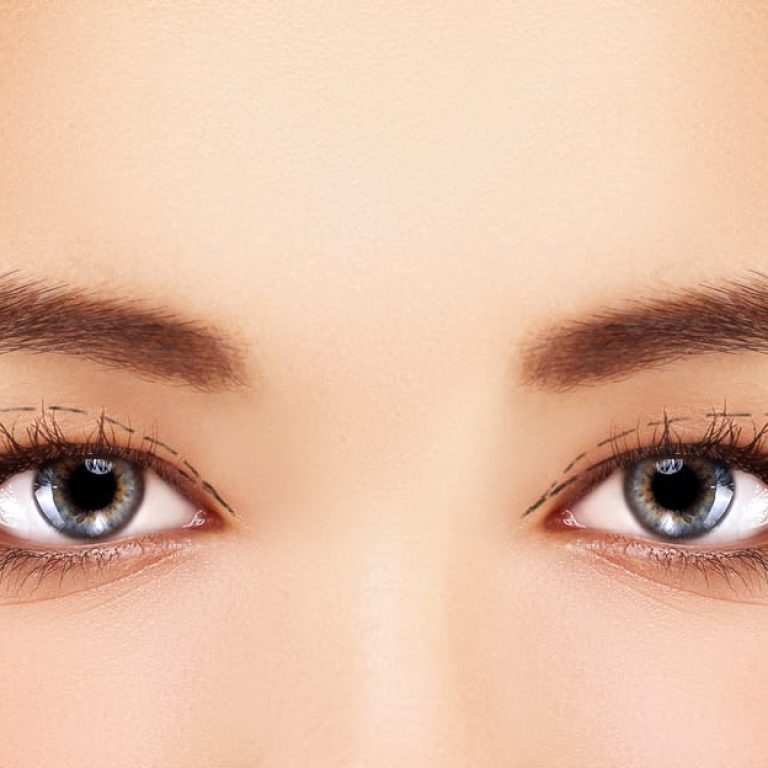 Looking for Eyelid Surgery Coral Springs Learn about benefits treatment options results and recovery for a smoother younger eye appearance today.