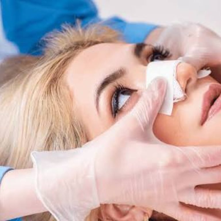Why Choosing the Best Facelift Doctor in Coral Springs Matters